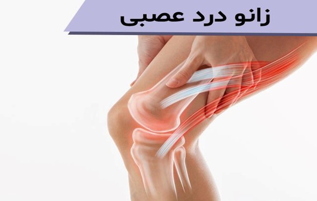 علل به وجود آمدن زانو درد عصبی